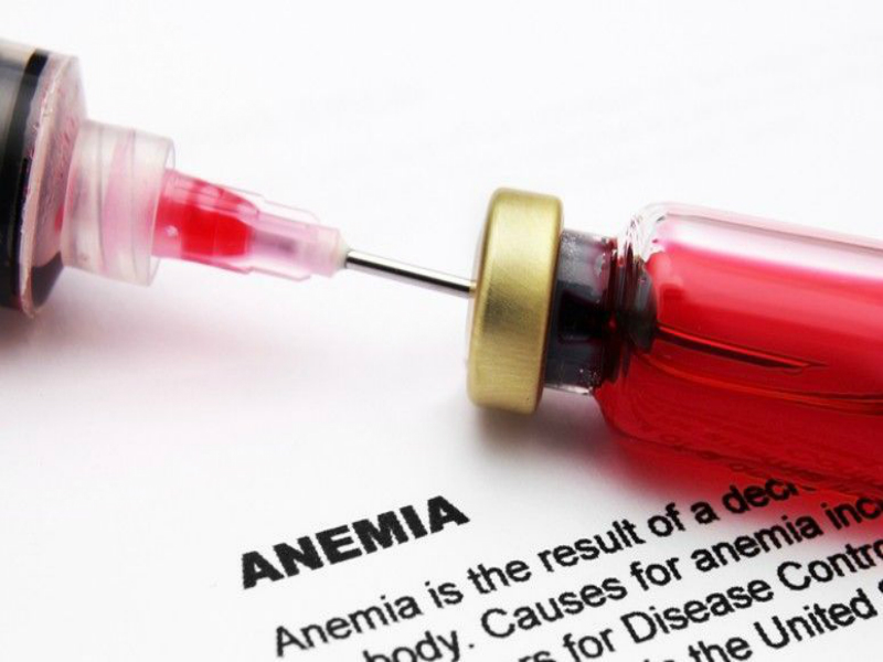 Anemia: como identificar os primeiros sintomas da doença?
