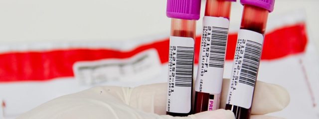 Conheça 4 dicas indispensáveis para se preparar para o exame de sangue