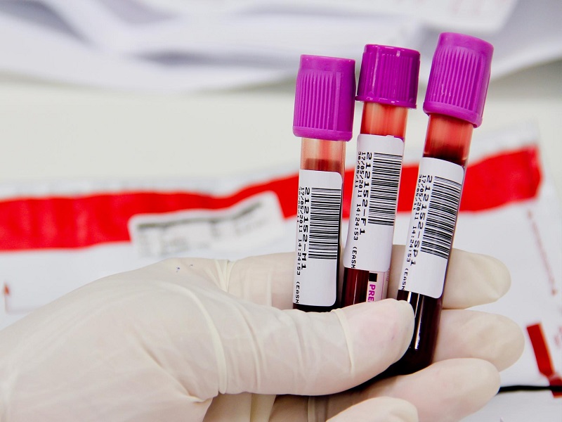 Conheça 4 dicas indispensáveis para se preparar para o exame de sangue