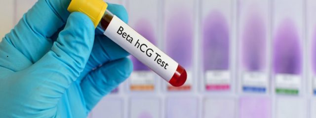 Beta HCG: desvendando o exame de gravidez