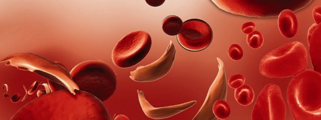 Sintomas de anemia: conheça os principais sinais do distúrbio