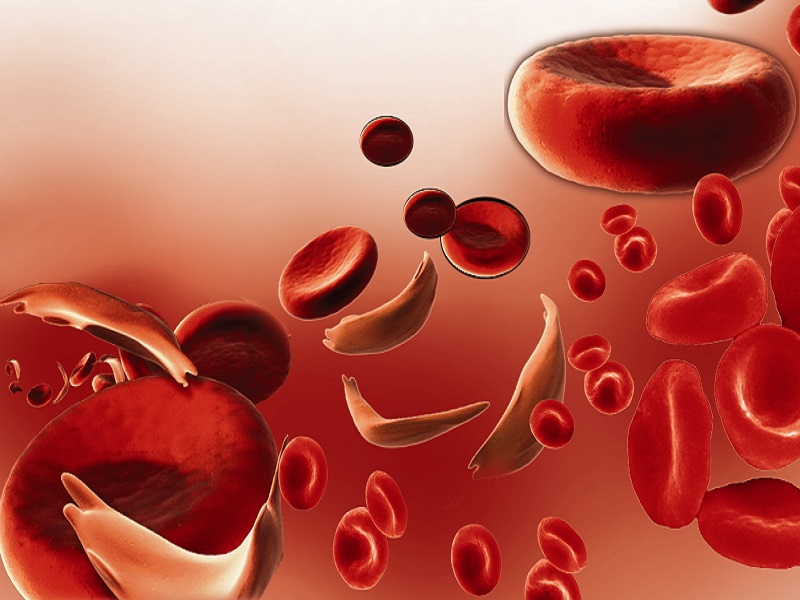 Sintomas de anemia: conheça os principais sinais do distúrbio